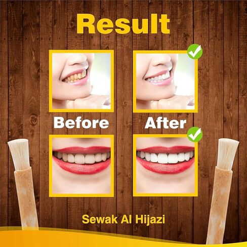 حزمة من 6 عصي ميسواك فرشاة أسنان طبيعية لتبييض الأسنان ، صحة الفم والتنفس الطازج ، Siwak عصا عضوية فرشاة الأسنان الخشبية المختومة ، عصي ميسواك للأسنان المسع in Saudi Arabia