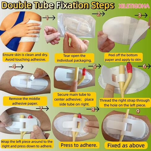 5 PCS Catheter Stabilization Device, Bulk Pack Adhesive Holder Stickers for Catheter Tube, Leg Bag & PEG Tube, Individually Wrapped Supplies in Saudi Arabia