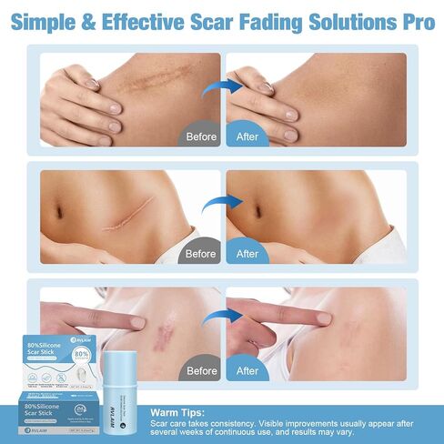 Silicone Scar Stick, 80% Silicone Stick for Face and Body. Silicone Stick for Removal of Surgical,Old and Recent Scars and Stretch Marks - 7g in Kuwait