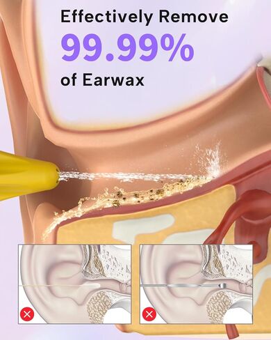 Upgraded Ear Wax Removal Kit, One Piece Waste Tank - Ear Irrigation Flushing System with 4 Modes & 8 Nozzles - IPX7, Safe and Effective Electric Ear Cleaner for Family Use, Type-C (Black) in Saudi Arabia