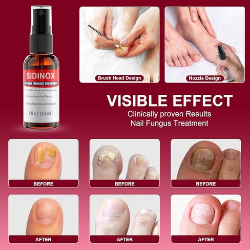 Toenail Treatment, Extra Strength Repairs Damaged Nail Liquid Treatment for Damaged Nail, Nail Discolored, Toenail, Help Nail Grow - Spray and Soft Brush Head (1 Fl Oz/30 ml x 2 Pack) in Saudi Arabia