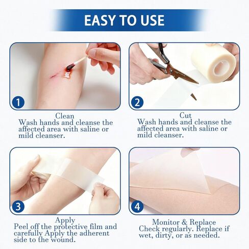 Hydrocolloid Bandages Roll，Medical Grade Hydrocolloid (2in*59in), Highly Absorbent Hydrocolloid Bandages for Wound Care, Burn, Blister, Acne Care, Waterproof & Cut to Required Size in Saudi Arabia