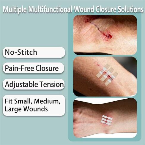 Emergency Wound Closure Strips 29 Pack, 4 Types Zip Stitch Butterfly Bandaids Without Suture, Stitchless & Painless Laceration Closure Kit Butterfly Bandages in Saudi Arabia