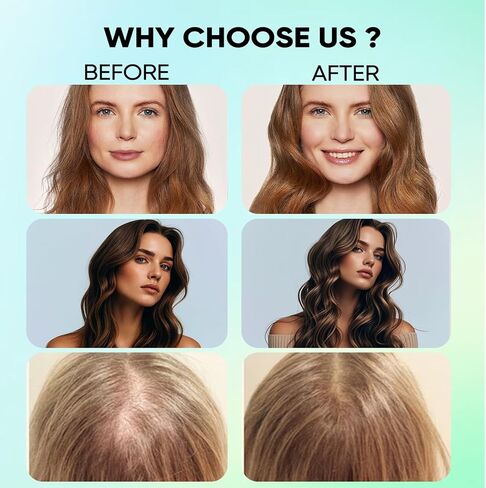 Revive Hair Gummies، Balmbare Revive Gummies للشعر، مع طحالب البحر الأيرلندية العضوية، مسحوق اللؤلؤ المتوهج، فيتامين C/E، الصبار، 60 قطعة in Kuwait