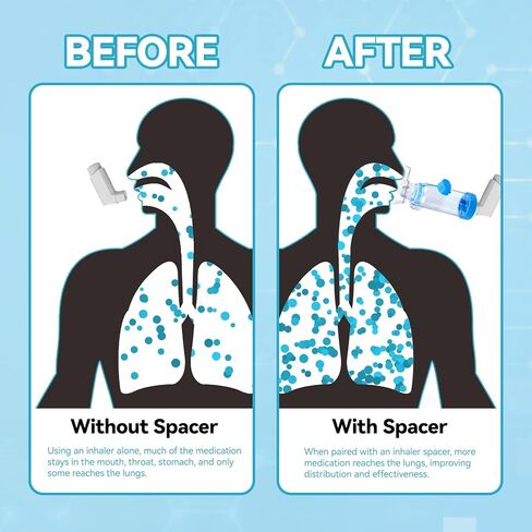 Inhaler Spacer for Adults Nessi OTC Spacer, FSA HSA Eligible, Spacer for Inhaler with Liquid Silicone Mask (Blue/Adult) in Saudi Arabia