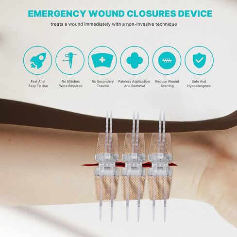 Emergency Wound Closure Strips 10 Pcs Zip Stitch Butterfly Bandages Laceration Closure Suture Kit, Adhesive Zip Tie Stitchless Painless Steri Strips for Wound Care in Saudi Arabia