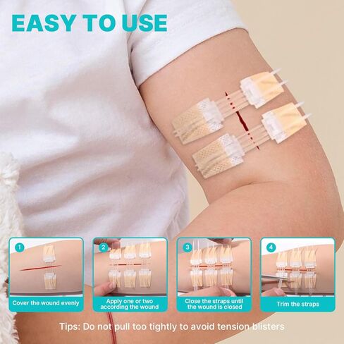 Emergency Wound Closure Strips 10 Pcs Zip Stitch Butterfly Bandages Laceration Closure Suture Kit, Adhesive Zip Tie Stitchless Painless Steri Strips for Wound Care in Saudi Arabia