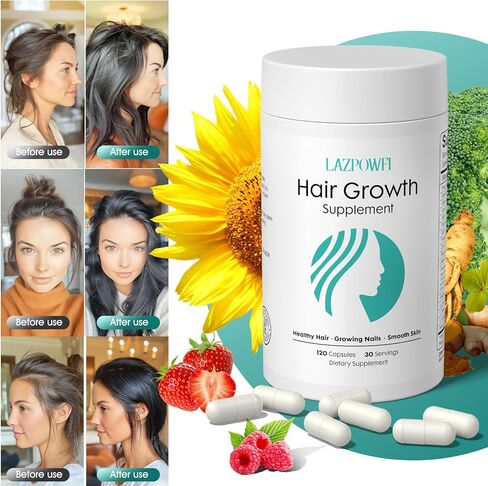 Hair Growth Products, Biotin 10000mcg, 30-in-1 with Vitamin A, B3, C, D, E, Calcium, Hair Growth Supplement, Supports Hair & Nails Natural Growth Vitamins, for Women & Men - 30 Servings in Saudi Arabia