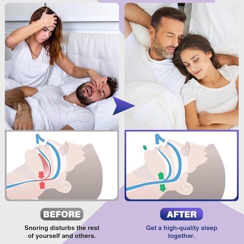 Anti Snoring Devices, Snore Stopper with Adjustable Magnet, Silicone Nose Clip Stop Snoring, Effective to Relieve Snoring, Snoring Solution for Comfortable and Quieter Sleep,White,M in Saudi Arabia