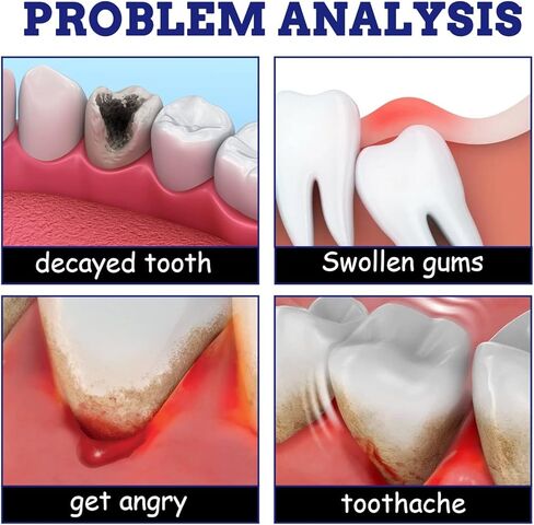 Tooth Pain Relief for Adults Spray,Treatment Tooth Ache Nerve Pain Medicine,Quicklynumbs Nerve Wisdom Tooth Inflammation,Red and Swollen Gums, and Other Types of Dental（1Pcs） in Saudi Arabia