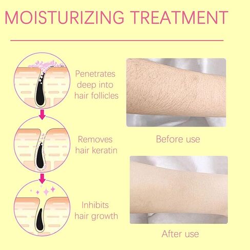 زيت نبات السرس روتوندوس العطري الطبيعي النقي 100%، 2 أونصة سائلة للعناية بالبشرة وإدارة الشعر، يدعم تقليل نمو الشعر غير المرغوب فيه (01) in Kuwait