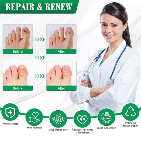 Toe Nail Fungus Renewal Pen, Toenail Fungus Renewal, 3 Packs Powerful Fast Acting For Thick, Discolored, Broken & Damaged Toe & Finger Nail in Saudi Arabia