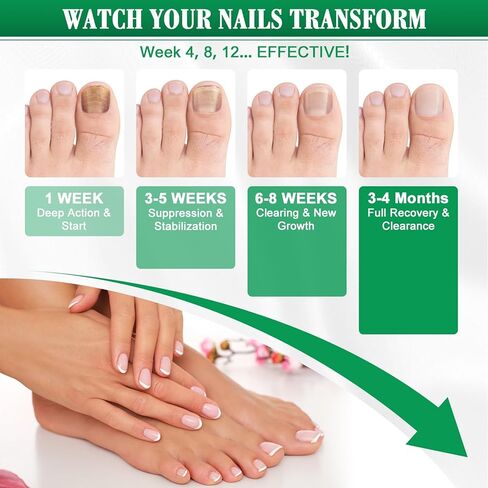 Toe Nail Fungus Renewal Pen, Toenail Fungus Renewal, 3 Packs Powerful Fast Acting For Thick, Discolored, Broken & Damaged Toe & Finger Nail in Saudi Arabia