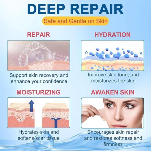 عصا السيليكون للندبات، كريم الندبات مع فيتامين E وزبدة الكاكاو للندبات، ندوب التلاشي، ترطيب عميق، خفيف وغير دهني، عصا إصلاح الندبات للندبات القديمة والحديثة وعلامات التمدد | 20 جرام in Kuwait