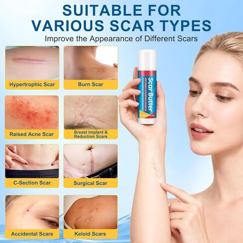 عصا السيليكون للندبات، كريم الندبات مع فيتامين E وزبدة الكاكاو للندبات، ندوب التلاشي، ترطيب عميق، خفيف وغير دهني، عصا إصلاح الندبات للندبات القديمة والحديثة وعلامات التمدد | 20 جرام in Kuwait