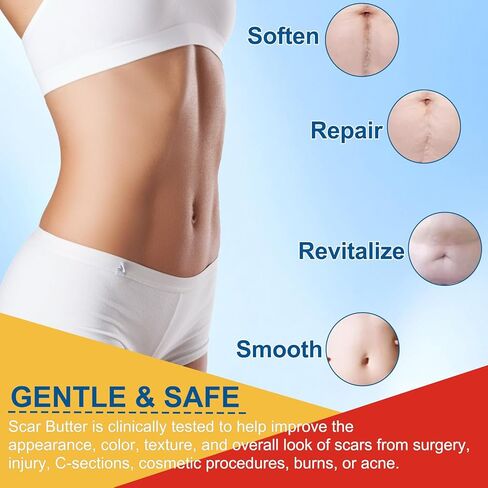 عصا السيليكون للندبات، كريم الندبات مع فيتامين E وزبدة الكاكاو للندبات، ندوب التلاشي، ترطيب عميق، خفيف وغير دهني، عصا إصلاح الندبات للندبات القديمة والحديثة وعلامات التمدد | 20 جرام in Kuwait