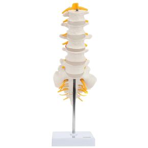 Axis Scientific Lumbar Spine Anatomy Model with Sacrum and Spinal Nerves, Didactic Replica Demonstrates Lumbrosacral Section with Nerves and A Herniated Disc At L4 - Includes Base for Display and