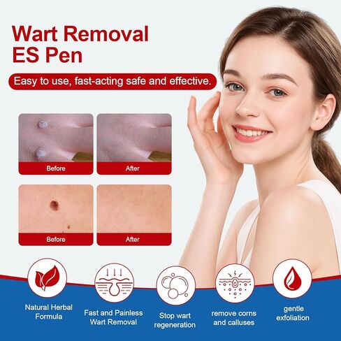 BEHATMH 3 Pack Wart Remover with Precision Tip, Maximum-Strength Salicylic Acid for Common & Plantar Warts, Targeted Mess-Free Application for Hands & Feet, Easy Daily Use in Saudi Arabia