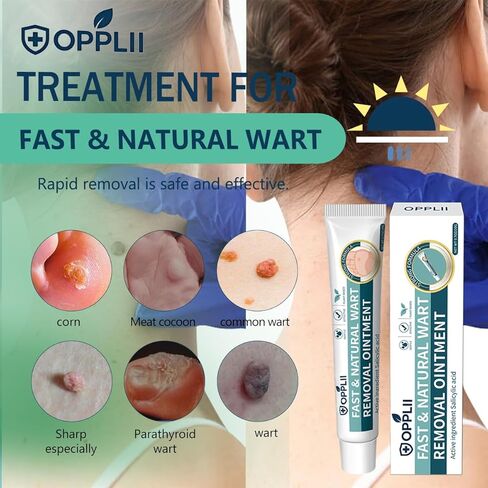 opplii 17% Salicylic Acid Wart Remover Ointment, Fast-Acting Natural Formula for Common, Plantar & Flat Warts Removal in Saudi Arabia
