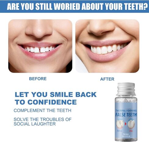 Thermal Forming False Teeth, 30ml, Reusable Super Strong Non-Toxic Dental Solution (1 Bottle) in Kuwait