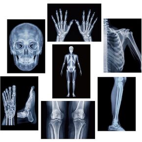 FunooFuno 7 Pcs X-Ray Science Education Package Bones X-Rays for Human Anatomy and Bone Parts Teaching Aids for Medical Workers is Suitable for Light Table and Lamp Fittings in Kuwait