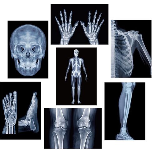 FunooFuno 7 Pcs X-Ray Science Education Package Bones X-Rays for Human Anatomy and Bone Parts Teaching Aids for Medical Workers is Suitable for Light Table and Lamp Fittings in Kuwait