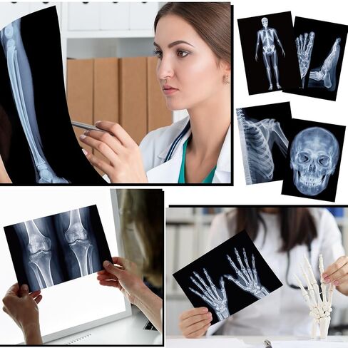 FunooFuno 7 Pcs X-Ray Science Education Package Bones X-Rays for Human Anatomy and Bone Parts Teaching Aids for Medical Workers is Suitable for Light Table and Lamp Fittings in Kuwait