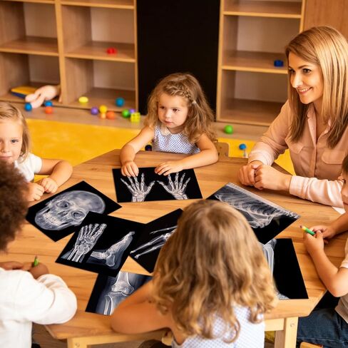 FunooFuno 7 Pcs X-Ray Science Education Package Bones X-Rays for Human Anatomy and Bone Parts Teaching Aids for Medical Workers is Suitable for Light Table and Lamp Fittings in Kuwait