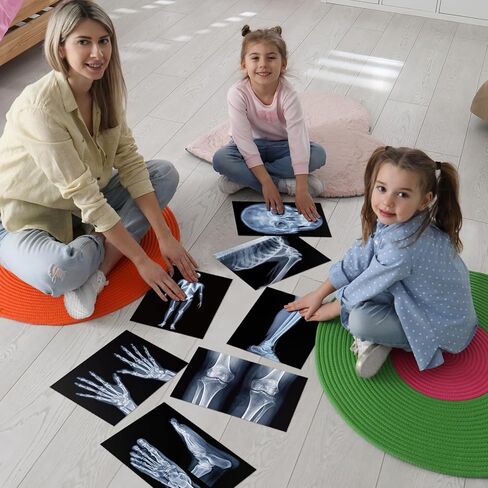 FunooFuno 7 Pcs X-Ray Science Education Package Bones X-Rays for Human Anatomy and Bone Parts Teaching Aids for Medical Workers is Suitable for Light Table and Lamp Fittings in Kuwait