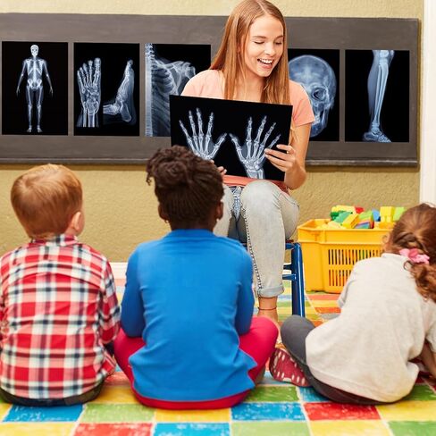 FunooFuno 7 Pcs X-Ray Science Education Package Bones X-Rays for Human Anatomy and Bone Parts Teaching Aids for Medical Workers is Suitable for Light Table and Lamp Fittings in Kuwait