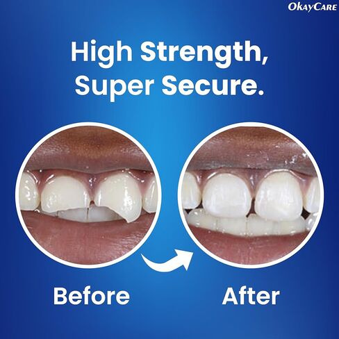 Zinc Oxide Eugenol Dental Cement Kit – Instant Tooth Repair, Cap, Crown & Bridge Filling | Ultra Strong & Pulp-Soothing Formula | Long Lasting - Easy Mix-and-Use Dental Adhesive for DIY, Home & Clinic in Kuwait