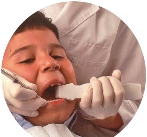 مسند فم واسع مفتوح سميك - (50 عبوة) in Kuwait