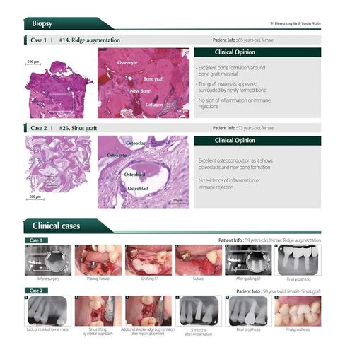 MedPark S1 Bovine Xenograft، 1 جرام، عظم لزج in Saudi Arabia