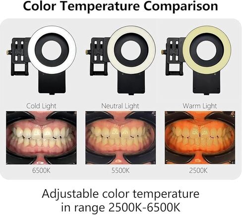 TsoLay Oral Cell Phone Camera Fill Light, Smartphone Dental Photography Light with 49mm Filter and 100mm Macro Lens, 3-Color Lighting & Color Temperature 2500K- 6000K, for Dentist in Saudi Arabia