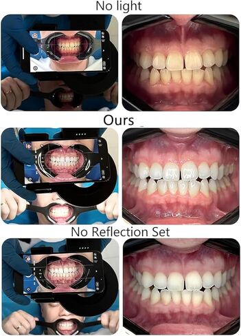 TsoLay Oral Cell Phone Camera Fill Light, Smartphone Dental Photography Light with 49mm Filter and 100mm Macro Lens, 3-Color Lighting & Color Temperature 2500K- 6000K, for Dentist in Saudi Arabia