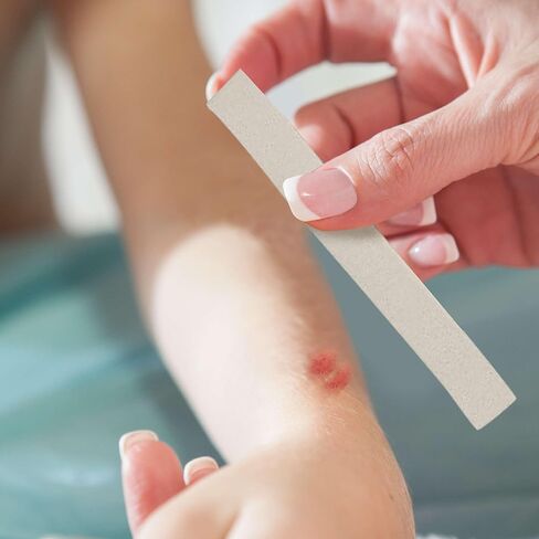 Calcium Alginate Rope - 5 Pack of .75 inches x 12 inches (2cm x 30cm) Calginate Dressings - Sterile and Highly Absorbent - Calcium Alginate Wound Dressings for Packing and More in Kuwait