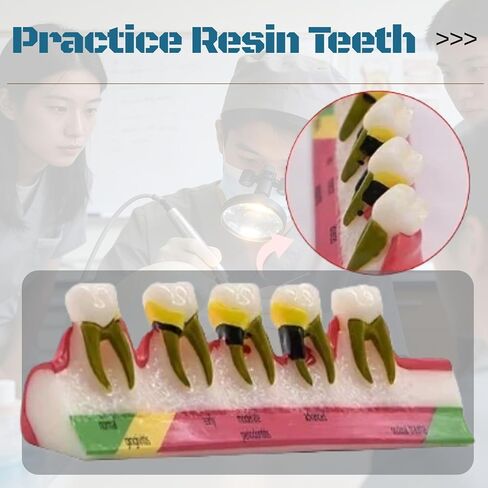 UKYCEORA Teeth Model,Dental Teeth Model,Dental Implant Model,Removable Analysis Crown Bridge Demonstration, Dental Model for Class Education.(periodontal) in Saudi Arabia