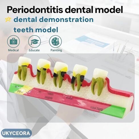 UKYCEORA Teeth Model,Dental Teeth Model,Dental Implant Model,Removable Analysis Crown Bridge Demonstration, Dental Model for Class Education.(periodontal) in Saudi Arabia