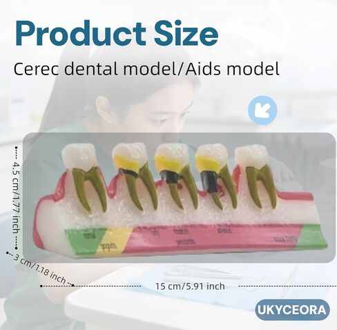 UKYCEORA Teeth Model,Dental Teeth Model,Dental Implant Model,Removable Analysis Crown Bridge Demonstration, Dental Model for Class Education.(periodontal) in Saudi Arabia
