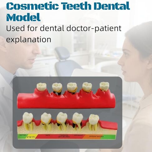 UKYCEORA Teeth Model,Dental Teeth Model,Dental Implant Model,Removable Analysis Crown Bridge Demonstration, Dental Model for Class Education.(periodontal) in Saudi Arabia
