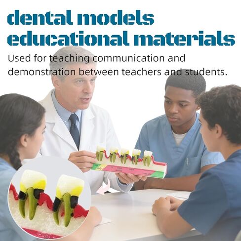 UKYCEORA Teeth Model,Dental Teeth Model,Dental Implant Model,Removable Analysis Crown Bridge Demonstration, Dental Model for Class Education.(periodontal) in Saudi Arabia