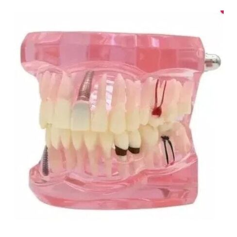 UKYCEORA Dental Teeth Model-Dental Hygiene Student Must Haves,Teeth Practice,Typodont Teeth Model,Dental Assistant Must Haves.（Repair） in Saudi Arabia