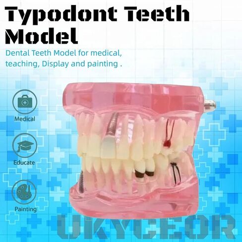 UKYCEORA Dental Teeth Model-Dental Hygiene Student Must Haves,Teeth Practice,Typodont Teeth Model,Dental Assistant Must Haves.（Repair） in Saudi Arabia