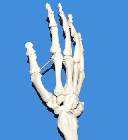 Human Skeletal Model Anatal Model of Human Skeleton of Upper Limb, Real Size 1: 1 Upper Limb Bone Scapula Arm Bone Clavicle Upper Arm Bone Osteopathic Pain Department Skeleton Model in Saudi Arabia