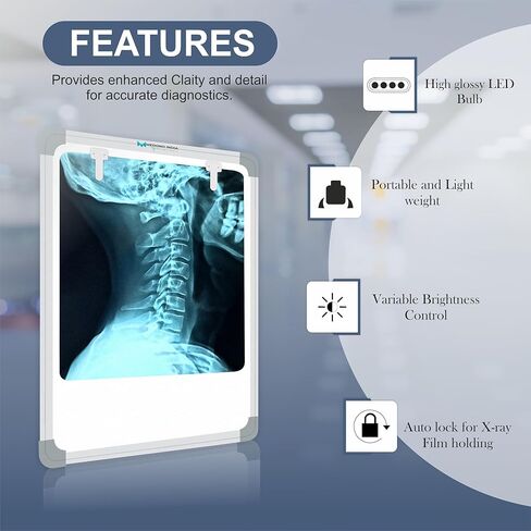 Medono India Fully Automatic LED X-Ray View Box | Auto Film Activation | Variable Brightness Control | Extra Bright LED Medical Film Viewer for Hospital & Clinic (36 X 45CM) in Saudi Arabia