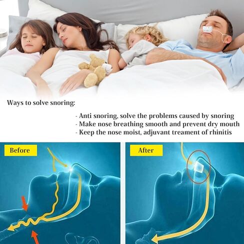 Anti snoring Devices,2024 New Atomization snoring Solution,Right Amount Fog,Adjustable Wind Force Sleep Apnea Devices for Comfortable Sleep in Kuwait