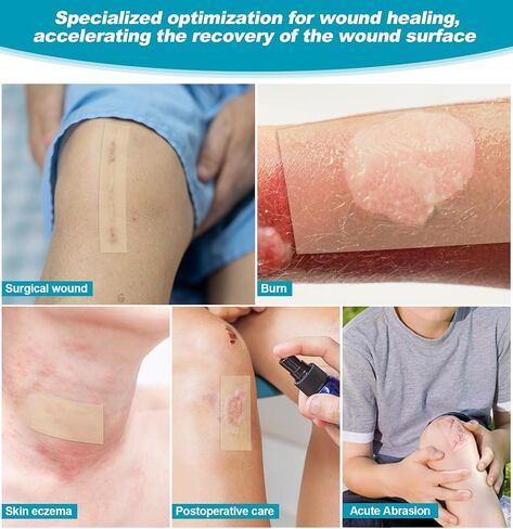 2Pcs Hydrocolloid Roll Medical Grade Bandages Tape - Pimple Patch Roll Acne Care Hydrocolloid Tape Large Wound Dressing - Waterproof Breathable Comfortable (2in x 10ft x 2Roll) in Saudi Arabia