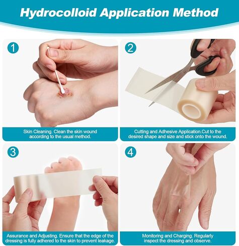 2Pcs Hydrocolloid Roll Medical Grade Bandages Tape - Pimple Patch Roll Acne Care Hydrocolloid Tape Large Wound Dressing - Waterproof Breathable Comfortable (2in x 10ft x 2Roll) in Saudi Arabia