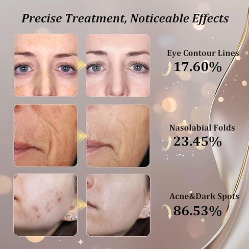 قناع علاج الضوء LED CUEME ، وعلاج RED LIGHT ذي 8 طرازات من FDA للتجاعيد والعناية بالبشرة ، وقناع الوجه المحمول ، وأفكار هدايا فريدة للنساء-أمي ، أخت ، صديقة وزوجة in Saudi Arabia
