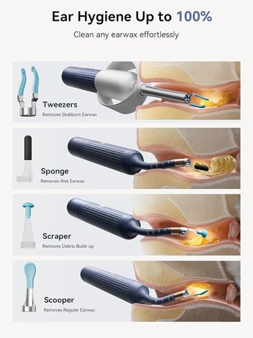 Ear Wax Removal Tool Kit: ZERONDER Ear Cleaner with Camera 1080P HD - Ear Canal Cleaning with 6 LED Lights for Adults & Kids in Saudi Arabia